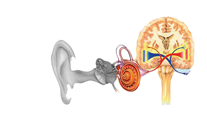 Sensorial Hearing Loss